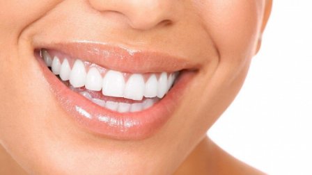 Cum să îţi albeşti dinţii acasă! Ce trebuie să faci pentru un zâmbet perfect