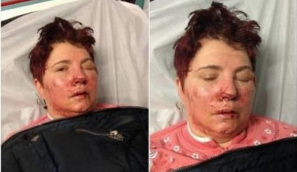 Panică și groază pe străzile din Botoșani! Cinci femei au fost bătute și jefuite