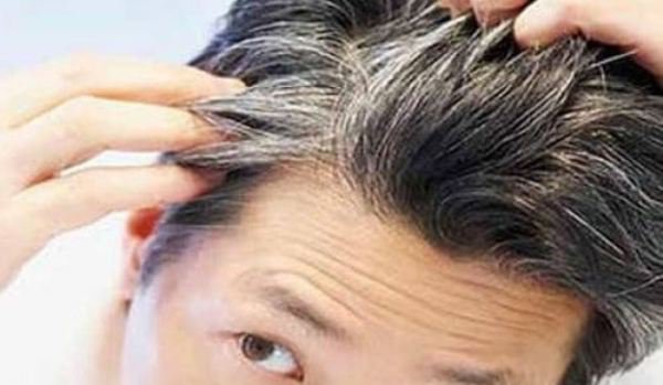 Cum prevenim albirea prematură a părului