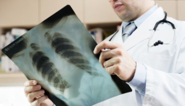 Cât de periculoase sunt radiografiile pentru organism