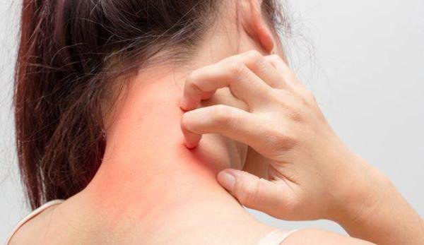 Ce trebuie să știm înainte de a trata o eczemă