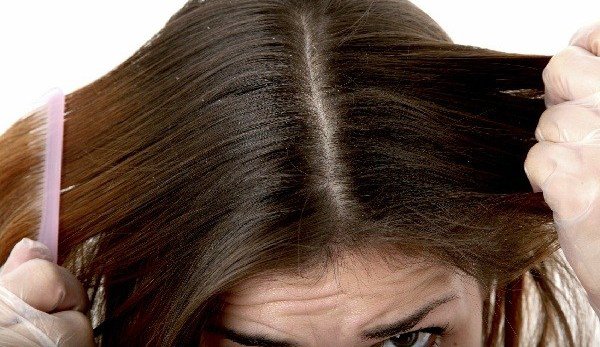 Vopseaua de păr naturală care impiedică formarea mătreții