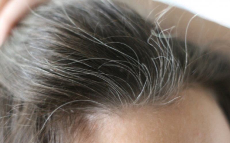 Remedii pentru a combate albirea prematură a părului