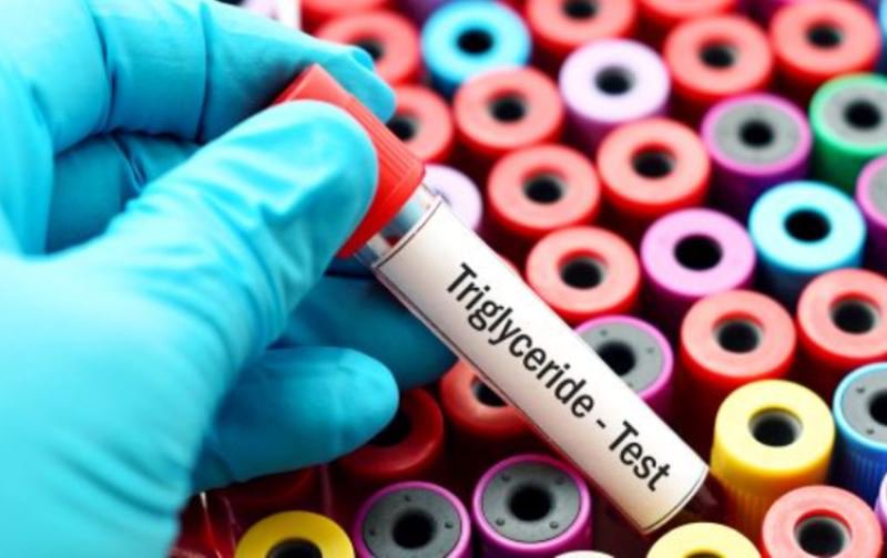 Ce putem face pentru scăderea trigliceridelor