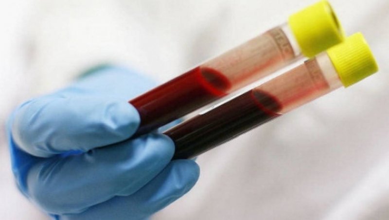 Particule de microplastic au fost descoperite pentru prima oară în sângele uman