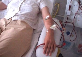 Pacienţii cu insuficienţă renală vor …