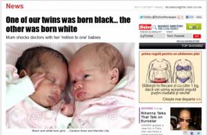 INCREDIBIL: Două gemene s-au născut …