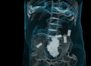 Un român, cărăuş de droguri: …