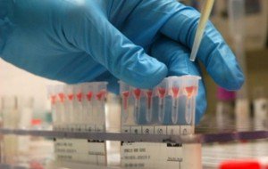 Program gratuit de depistare a …