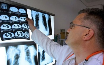 Decesele provocate de cancer s-au …