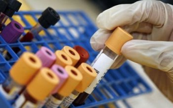 Botoşănean ajuns caz de studiu …