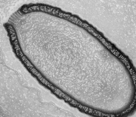 Savanţii au readus la viaţă un virus gigant, care stătuse 30.000 de ani îngheţat în solul Siberiei