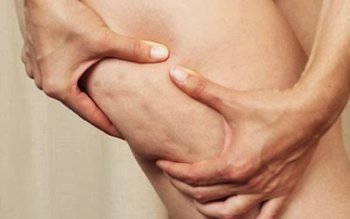 Cel mai bun remediu anti …