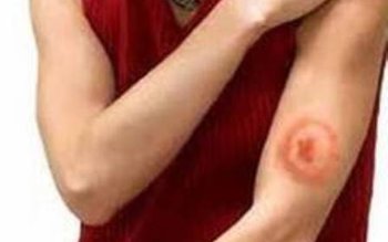 Ce trebuie să ştii despre …