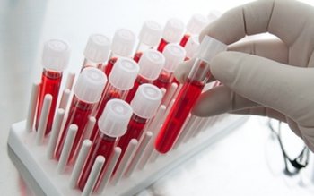 Persoanele cu grupa de sânge …