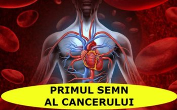 Simptome care anunţă cancerul. Nu …