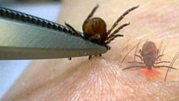 Atenţie la CĂPUŞE! Opt persoane au ajuns la UPU Botoşani în ultimele două săptămâni după ce au fost muşcate de aceste insecte