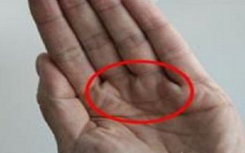 Nu toată lumea are această …