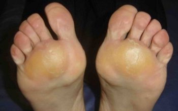 Cel mai bun remediu natural …