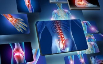 Probleme articulare grave pe care …