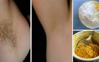 Cum să scapi de părul …