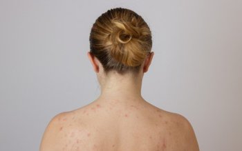 Cel mai simplă metodă pentru …