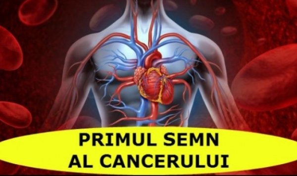 Acestea sunt primele semne ale cancerului pulmonar. Mergi urgent la medic dacă ai aceste simptome