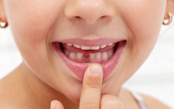 Medicii stomatologi îi îndeamnă pe …