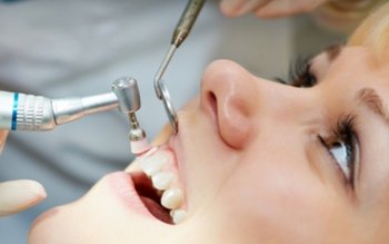 Ce este tartrul dentar și …