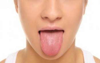 Ce înseamnă când ai un …