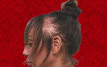 Vedeta care a rămas fără …