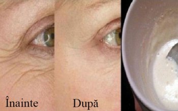 Trei măști eficiente împotriva ridurilor