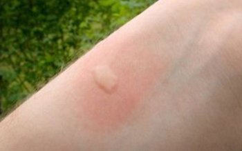 Ce trebuie să faci pentru …