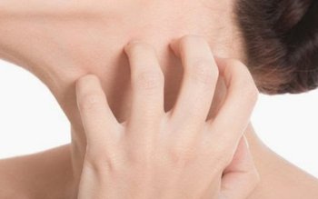 Ce faci când te mănâcă …