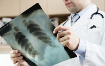 Cât de periculoase sunt radiografiile …