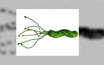 Ce trebuie să știm despre …