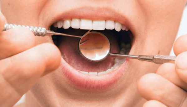 Cum prevenim parodontoza