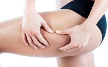 Remedii naturale interne pentru celuluită