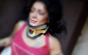 Tânără dansatoare româncă, bătută crunt …