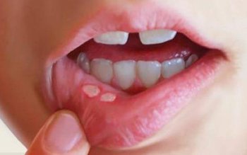 Cum intervenim în caz de …