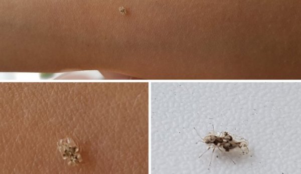 Mare ATENŢIE! Au apărut tigri de platan. Ce este, de fapt, insecta care terorizează românii?