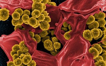 O nouă super-bacterie, extrem de …