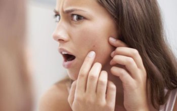 Cauza neașteptată a apariției coșurilor