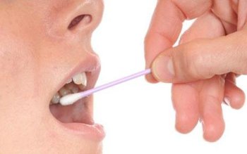 Boli transmise prin salivă