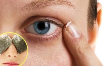 Trei soluții eficiente împotriva cearcănelor