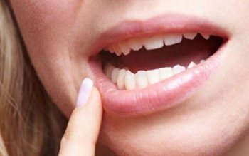 Igiena orală precară crește riscul …