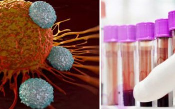 Semnele care anunță leucemia: care …