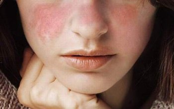 Boala care poate afecta multe …