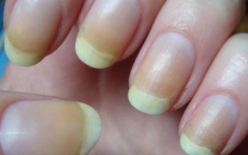 Ce ne spun unghiile despre …