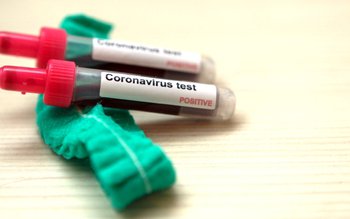 794 de cazuri confirmate și …